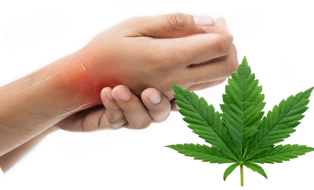cannabis for chronic pain management
